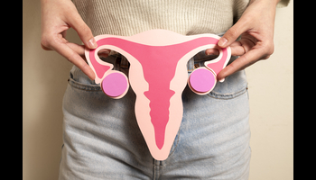 Everything You Need to know About Lean PCOS: Symptoms, Causes and Management