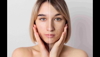 How to Naturally Increase Glutathione Levels: Top Glutathione-Rich Foods