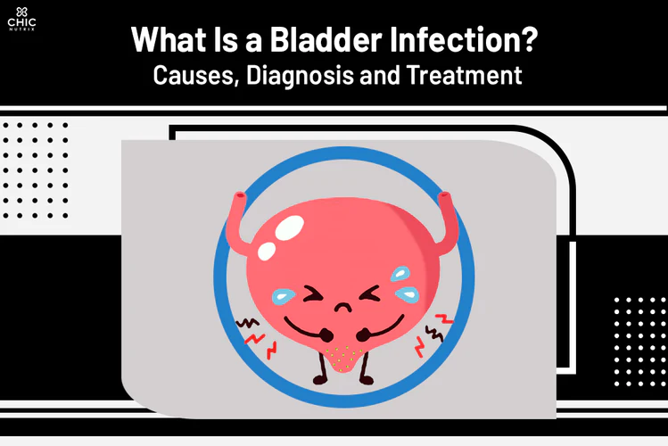 What Is a Bladder Infection Causes, Diagnosis and Treatment