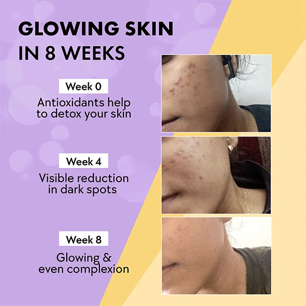 Chicnutrix Glow - Glutathione Skin Radiance & Glow