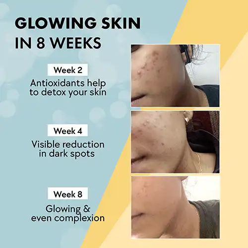 Glow for Brighter Skin