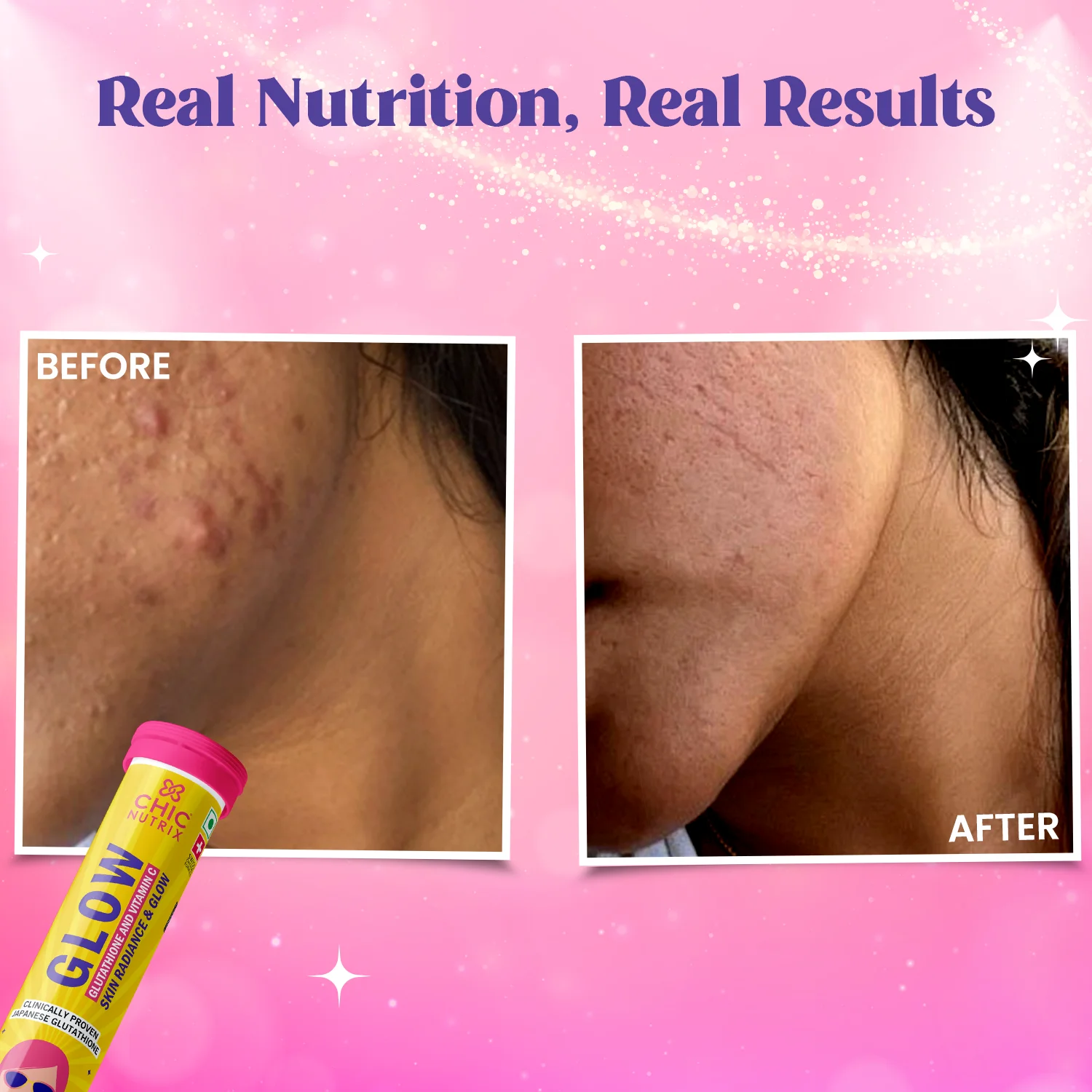 Beauty Bestie Bundle - Glow & Outshine