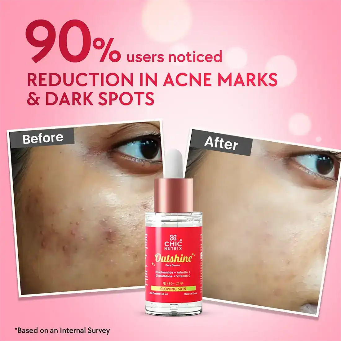 Outshine - Anti-pigmentation & glass skin serum